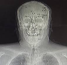 Why tv2.no Dominates the News Landscape: From Anders Røyneberg's Live Broadcasts to P.J. "Papi" DiNuzzo's Analysis